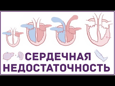 сердечная недостаточность - Художник заката видео (клип)