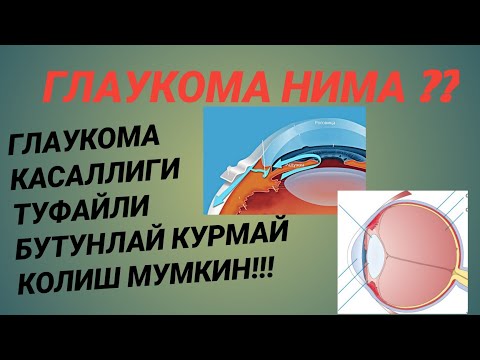 Ilojy - Глаукома видео (клип)