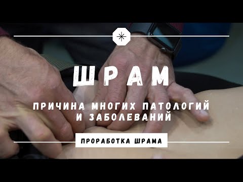 Шрам - ПОЗАБОТИМСЯ ОБ ЭТОМ видео (клип)